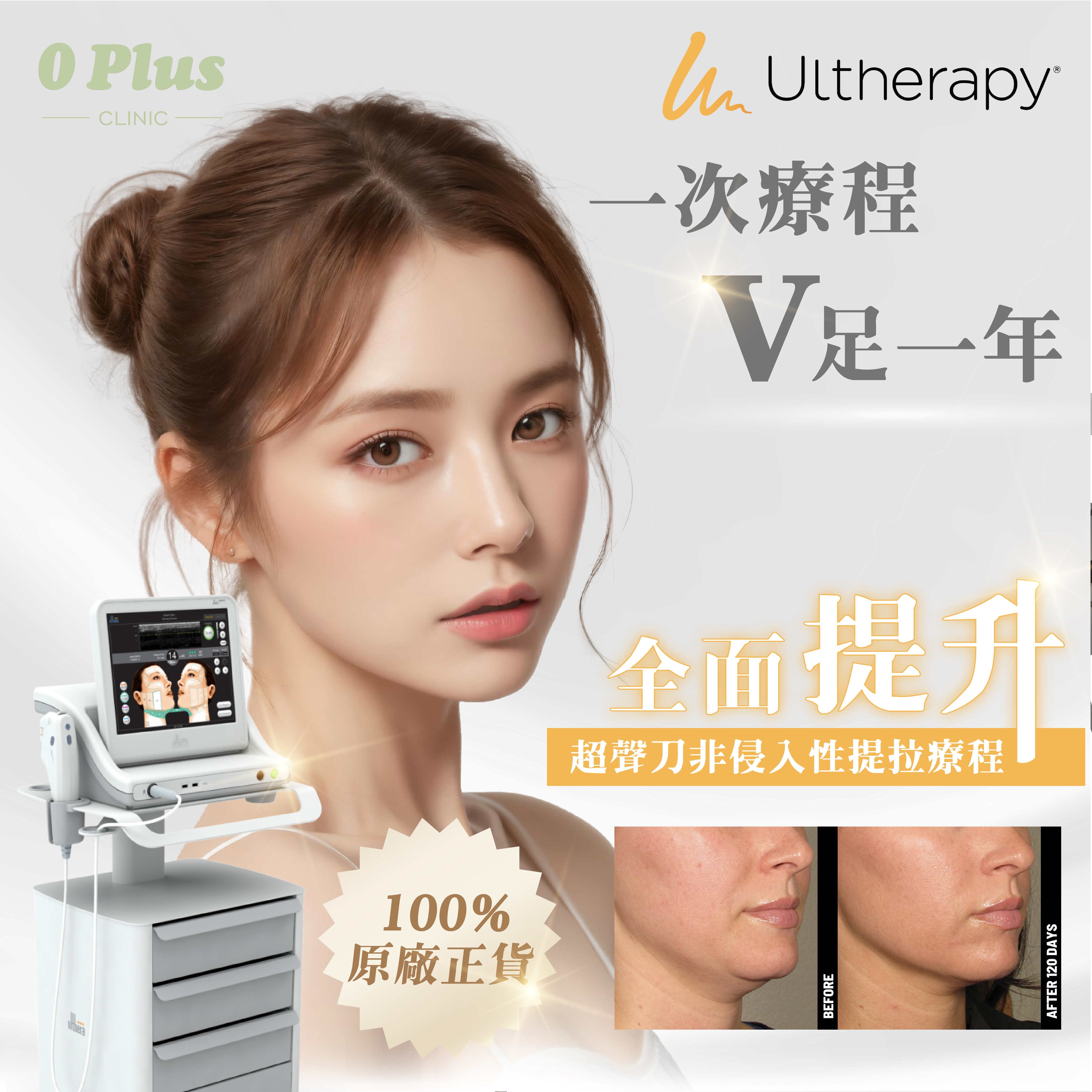 Ultherapy 超聲刀
