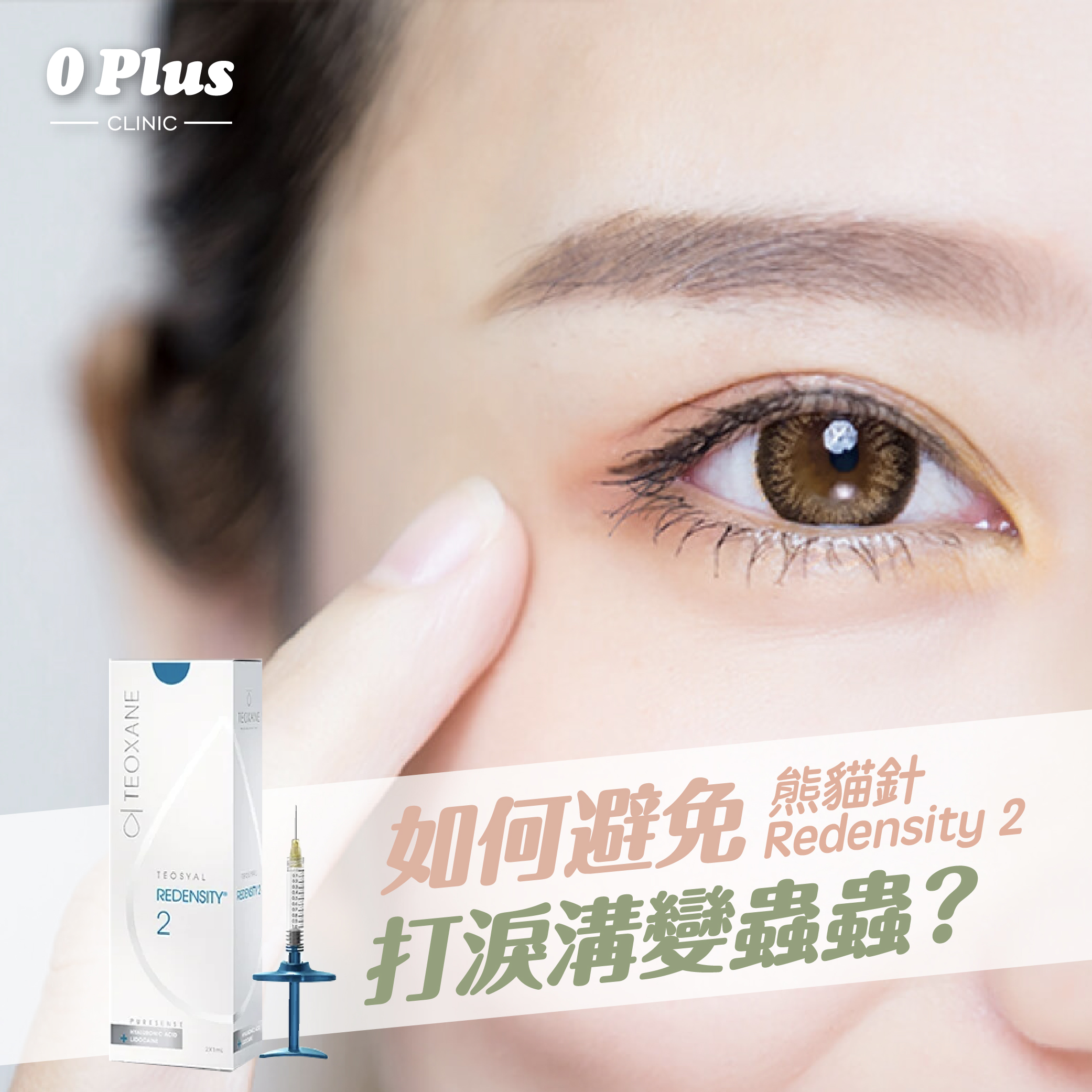 【熊貓針】如何避免熊貓針 Redensity 2 打淚溝變蟲蟲？詳解淚溝療程方法及效果