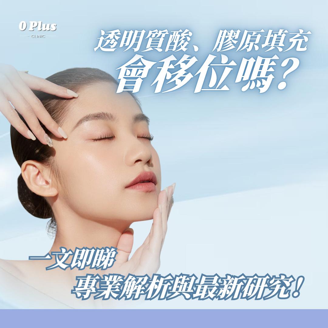 透明質酸填充、少女針 Ellansé、美神針 HArmonyCA 及其他膠原填充會移位嗎？專業解析與最新研究！