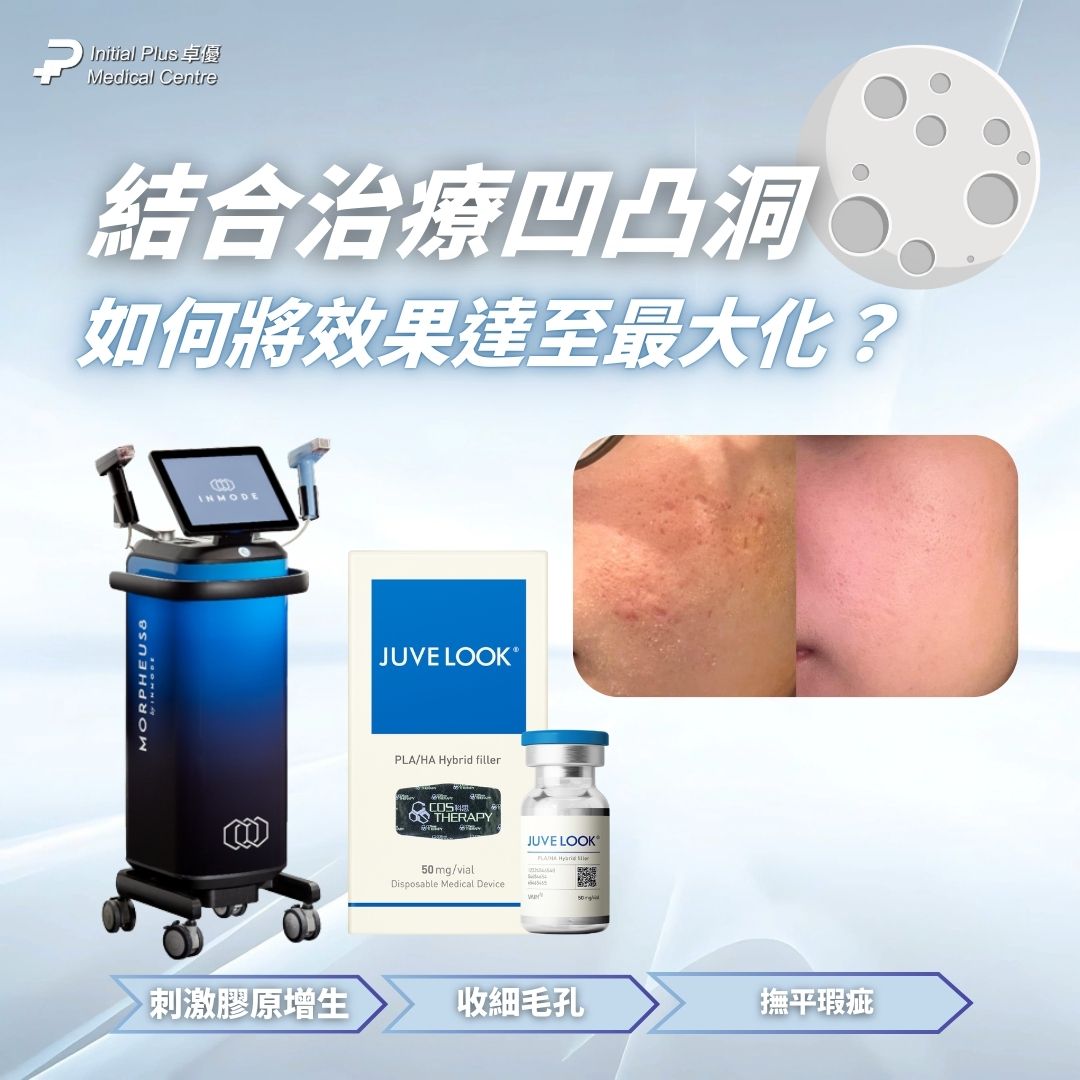 InMode Morpheus 8 墨菲斯微針射頻 與 Juvelook素顏針 結合治療凹凸洞,如何將效果達至最大化?